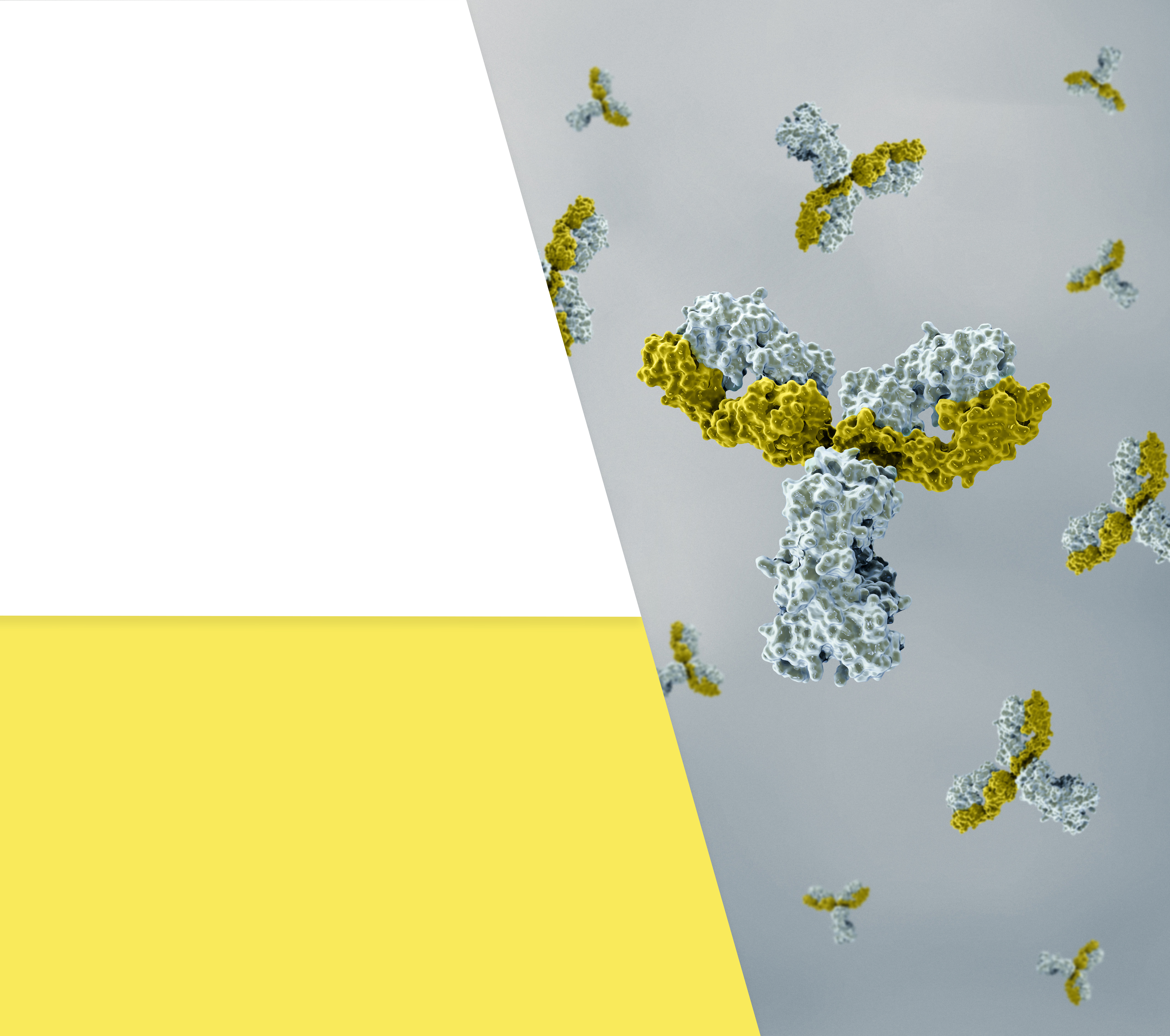 多发性骨髓瘤的病因及诊断